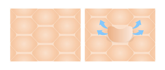 Dry and healthy skin texture , vector