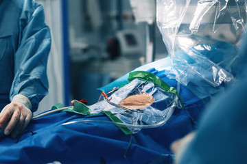 Interventional cardiologist surgeon do AAA endovascular treatment stent graft procedure for abdominal aortic aneurysm repair using wire catheter delivery system for stent with a hydrophilic coating