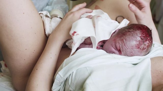 Tired woman hold on stomach newborn baby on maternity desk. Accoucheur gynecologist. Maternity home. Infant