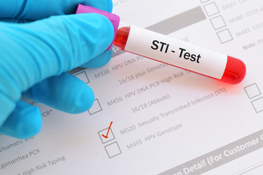Blood sample with requisition form for sexually transmitted infection (STI) test