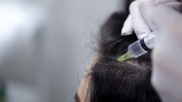 In the clinic, the cosmetologist makes mesotherapy injections to the client to improve the condition of the hair. Close-up