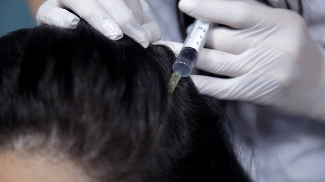 The doctor-cosmetologist performs the procedure of mesotherapy, injections into the skin of the head. Close-up