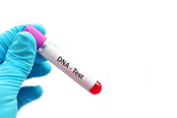 Fototapeta premium Test tube with blood sample for DNA test