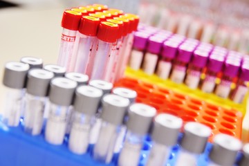 a glass test tube or a flask with blood in the hands of a scientist on the background of a laboratory
