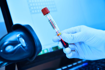 scanning bar code of test tubes in a bacteriological laboratory
