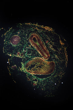 venae cava