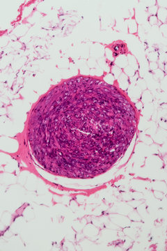 venae cava