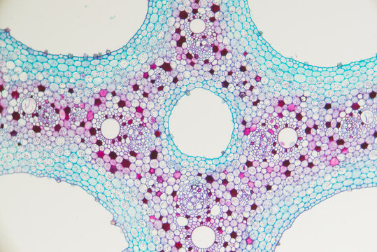 lotus stem spongy tissue