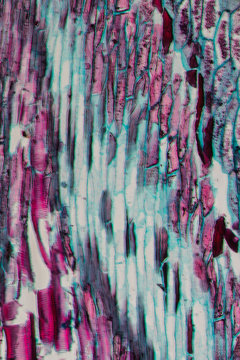 fern stem