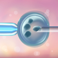 In vitro fertilization IVF, the egg, ovum, pipette and pipe horizontal, reproduction in humans illustration for an article, site, typography magazine, brochure, flyer, poster. Blurred pink background.