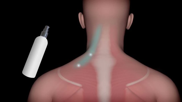 Spray and Stretch technique for trigger point release