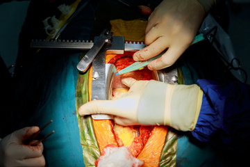 Beating human heart close-up in opened chest during the surgery