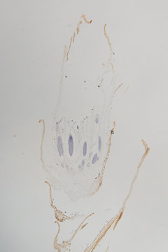 polyrtichum archegonis, moss reproductive parts