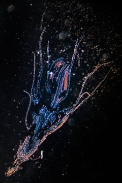 Moss reproductive parts Polytrichum Antheridia