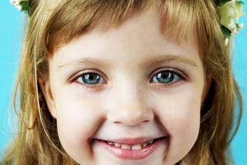 Caries on milk teeth. The girl is smiling happily, close-up of teeth with tooth decay. Large blue eyes of a girl. The concept of dental care