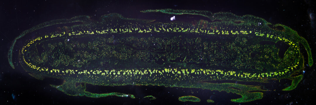 Tapeworm, Taenia Pisiformism