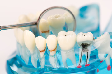 Fototapeta na wymiar close up dental or tooth model with mirror