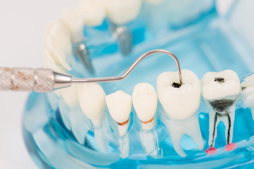 Fototapeta na wymiar close up dental or tooth model with dental tool