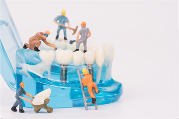 miniature people clean tooth or dental model,medical concept