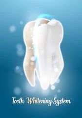 Illustration of Vector Teeth Cleaning Healthcare Stomatology Procedure. Realistic Vector Tooth Cleaning Process