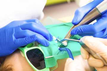 Close-up of a female dentist in medical uniform and sterile gloves and her assistant polish teeth with a dental plaque drill and treat the caries to a child. Dentist heals teeth