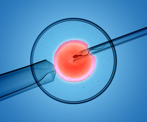 3D rendering of the icsi (intracytoplasmic sperm injection) process - in which a single sperm is injected directly into an egg