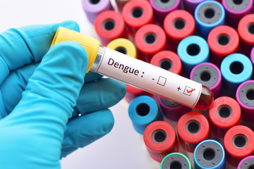 Fototapeta premium Dengue virus positive