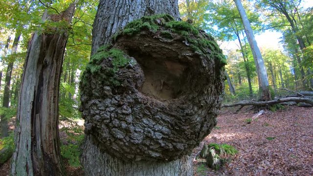 Krebswucherung an Eichenstamm, Krebs, Baumkrankheit, Eichenrinde, Baumstamm, Eiche, Quercus, Spessart, 4K