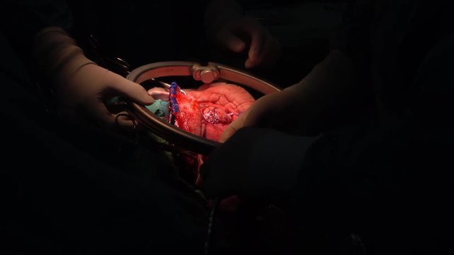 brain surgery