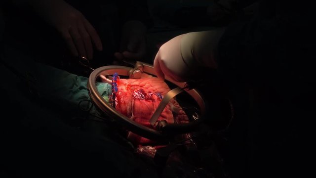 brain surgery