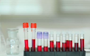 Blood Test tubes in laboratory , in the hospital.
