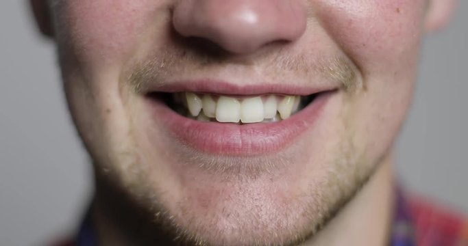 Close-up of a male mouth with crooked teeth.