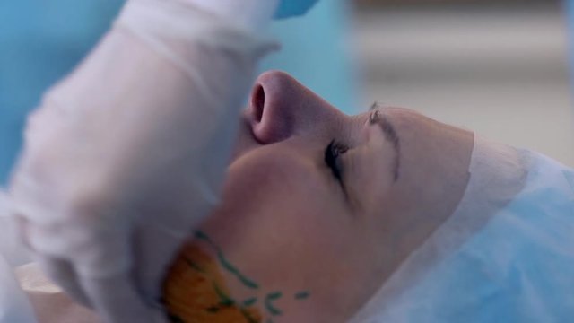 closeup picture of adult woman lying on table in operating room with closed eyes while paramedic sterilizing her neck with markings doing prepairings before surgery reallife