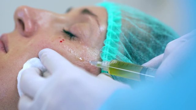 closeup picture of woman getting botox injection under her eyes lying with closed eyes in medical hat in clinic 