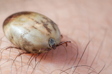 Tick filled with blood sitting on human skin