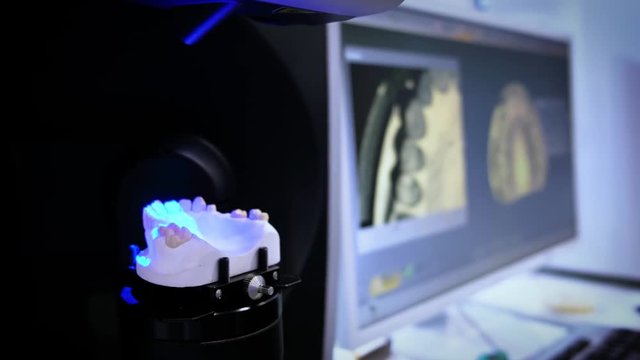 Dental prosthetic restoration. Denturist is making 3D model for sculpted plastic denture with high tech digital scanning equipment. 3d tooth scanning