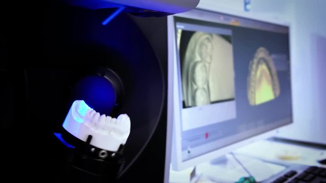 Dental prosthetic restoration. Denturist is making 3D model for sculpted plastic denture with high tech digital scanning equipment. 3d tooth scanning