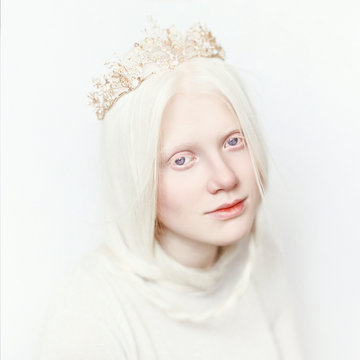 Albino Model Stock Photos And Royalty Free Images Vectors And Illustrations Adobe Stock