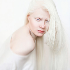 Albino girl with white skin, natural lips and white hair. Photo face on a light background....