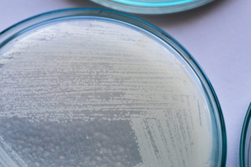Yeasts are eukaryotic, single-celled microorganisms classified as members of the fungus kingdom, Microbiology for education in laboratories.