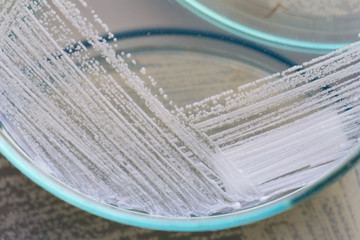 Yeasts are eukaryotic, single-celled microorganisms classified as members of the fungus kingdom, Microbiology for education in laboratories.