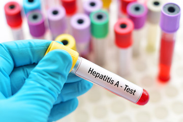 Hepatitis A virus test