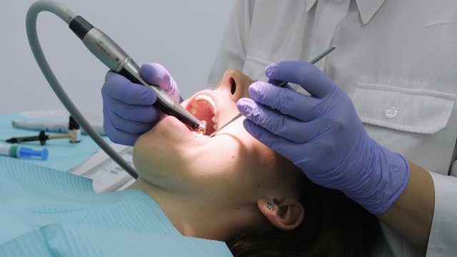 Female dentist polishing client's lower teeth.