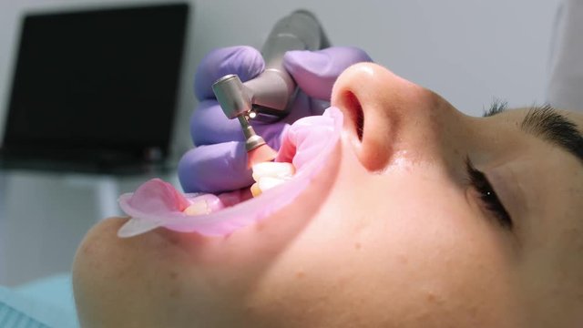 Close-up shot of a dentist using equipment to polish womans teeth.