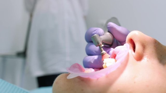 Close-up shot of a dentist using equipment to polish womans teeth.