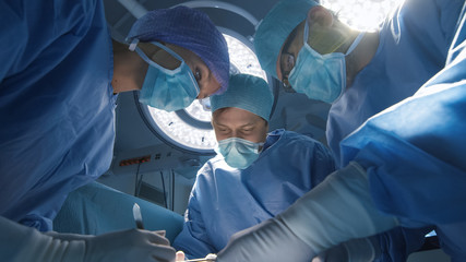 Low Angle View of Team of Doctors Performing Surgical Operation. Patient Point of View.