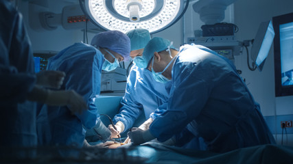 Close up Shot of Medical Team Performing Surgical Operation in Modern Operating Room