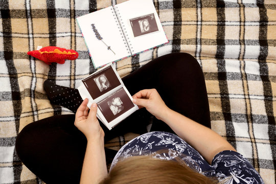Young mother waiting baby, holding ultrasound image. Concept of pregnancy, health care, medicine.