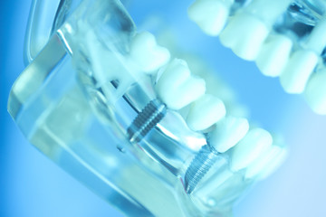 Dental teeth mouth model