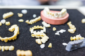 Denture treatment, prosthetic dentistry, implants